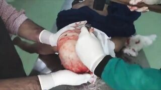 Autopsy Time