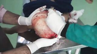 Autopsy Time