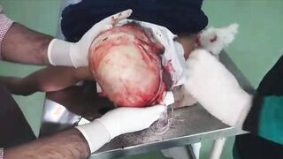 Autopsy Time